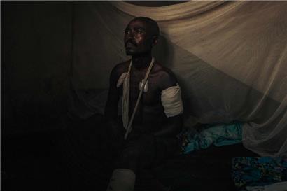 Vergessener Konflikt: Ein verwundeter kongolesischer Milizionär sitzt in einem Krankenhaus in der Nähe der Front zwischen der kongolesischen Armee und den M23-Rebellen. Das Bild ist vom 4. Mai. 
