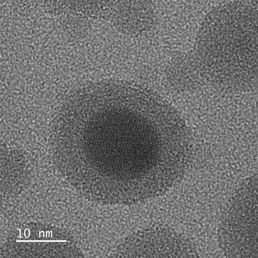 Zinn in einer Aufnahme des Luxemburger Elektronenmikroskops: In der Bildmitte ze...