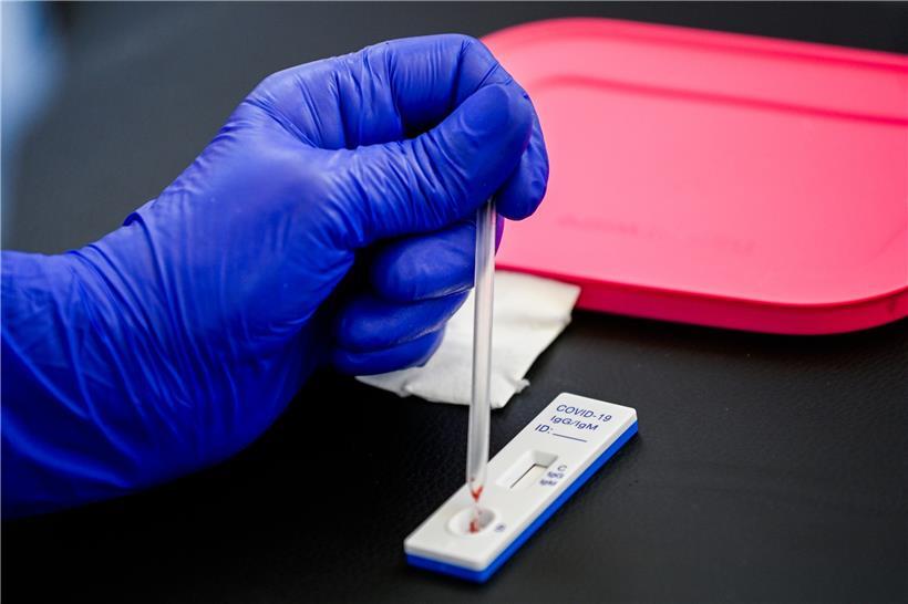 Zwei Patienten aus Luxemburg wurde in Deutschland eine klinische Behandlung verweigert, obwohl sie negativ auf das Coronavirus getestet wurden
