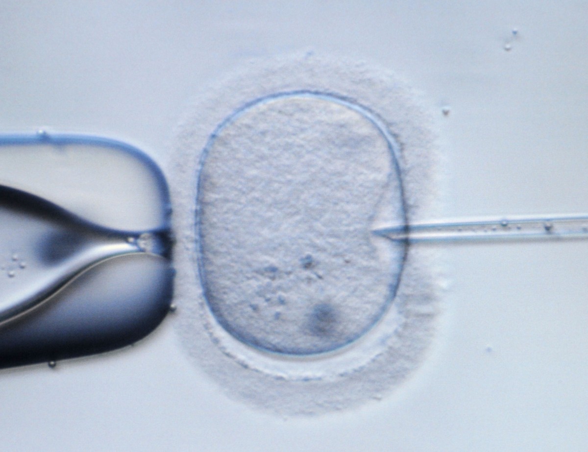 Forscher reparieren Gendefekt an menschlichen Embryonen