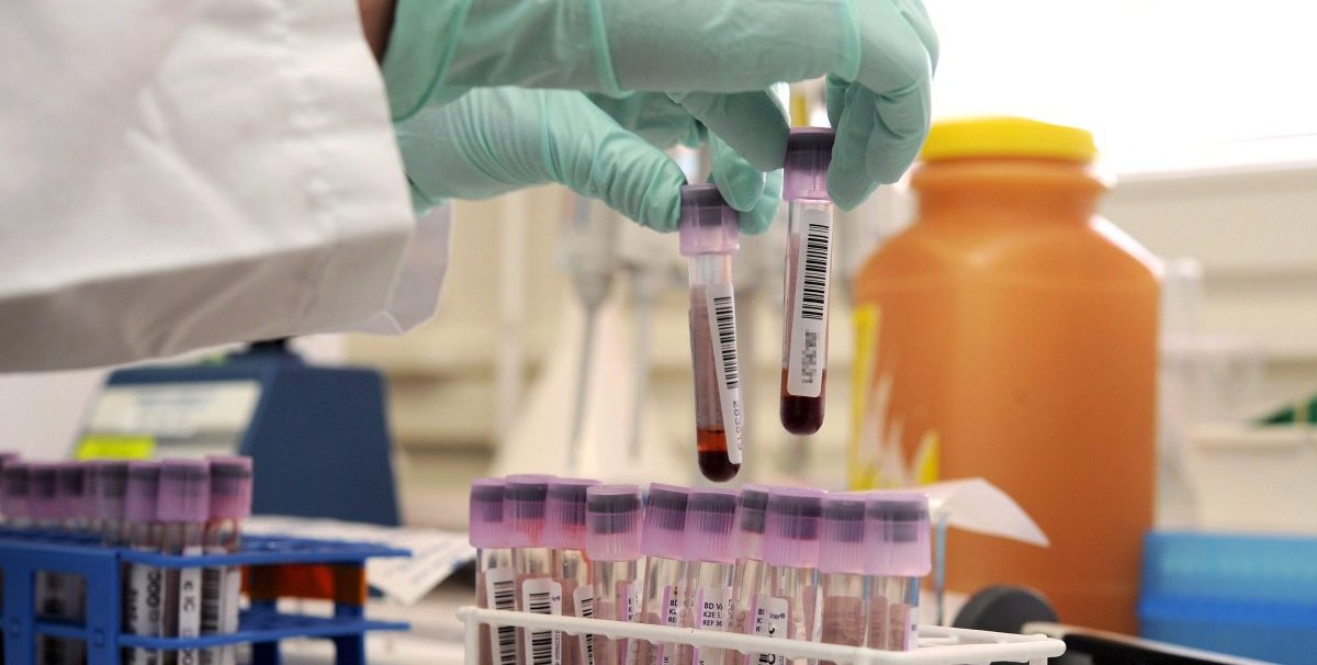 Abhilfe nötig: Politik steht im Kampf gegen Doping in der Bringschuld