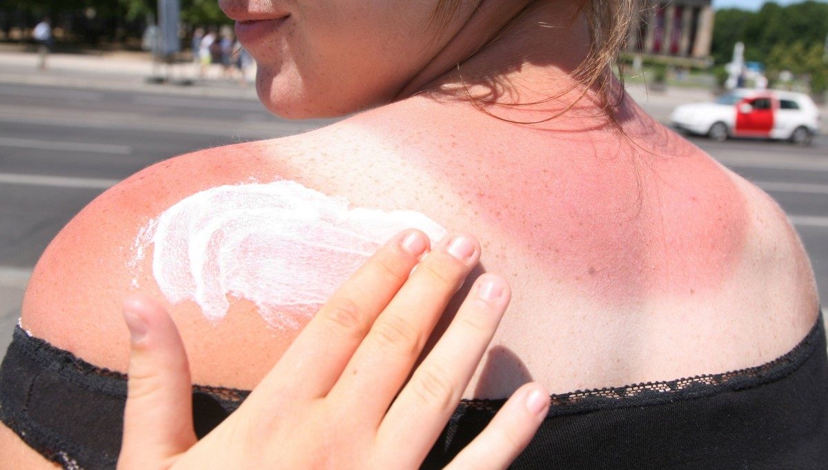 Sonnenbrand und Mückenstiche: Die Haut hat im Sommer Stress