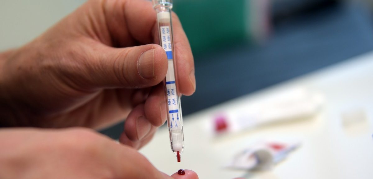 „Leute motivieren, sich zu testen“: HIV-Selbsttest kommt auch bald nach Luxemburg