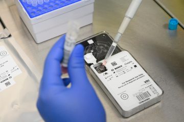 Coronavirus / Regierung registriert 2.178 Corona-Infizierte in Luxemburg – 23 Todesfälle