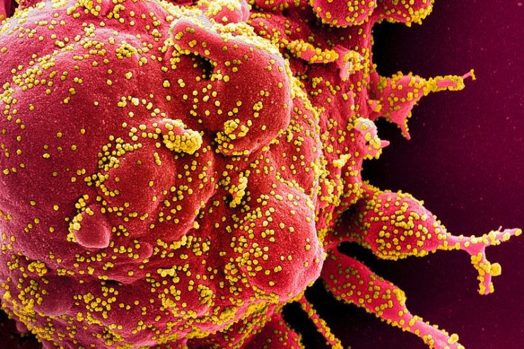 Corona-Epidemie / 3.930 Menschen in Luxemburg positiv auf Corona getestet – Zahl der Toten bleibt bei 104
