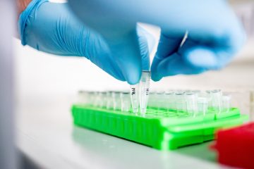 Corona-Epidemie / 3.993 Menschen in Luxemburg positiv auf Corona getestet – Zahl der Toten bleibt bei 110