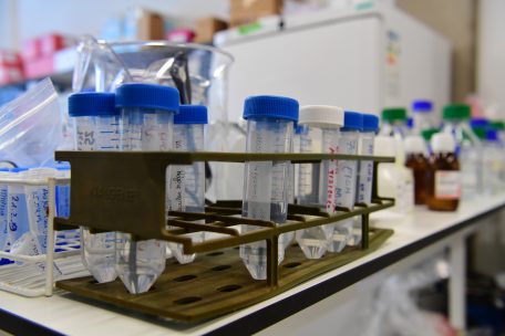 Forschung / Die „Darmpolizei“ braucht gutes Essen: Mahesh Desai über das menschliche Immunsystem