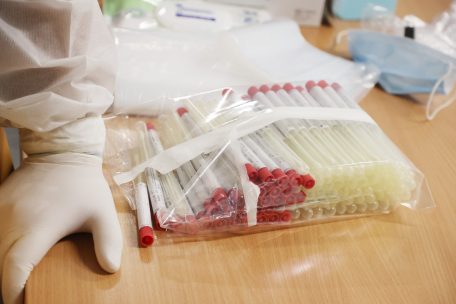 Statistik / „Santé“ verzeichnet 35 Neuinfektionen – davon 28 bei Einheimischen