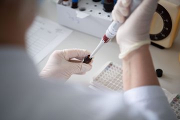 Coronavirus / Gesundheitsministerium meldet am Donnerstag 65 Neuinfektionen in Luxemburg