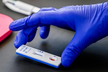 Coronavirus / Santé meldet 177 Neuinfektionen am Freitag - Contact Tracing Team in Luxemburg muss aufgestockt werden