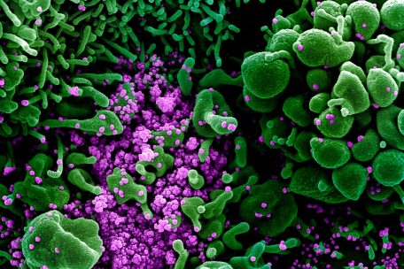 Coronavirus / Neun Neuinfektionen und ein weiterer Todesfall – 48 Patienten im Krankenhaus