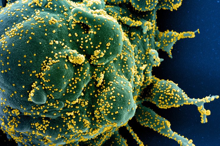 Coronavirus / Trauriger Rekord – „Santé“ meldet 595 Neuinfektionen am Donnerstag