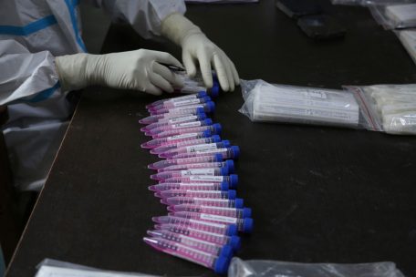 Coronavirus / Santé meldet am Sonntag 849 Neuinfektionen – 3 weitere Menschen sterben