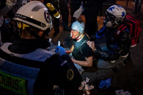 Ameer al Halbi, photographe indépendant d’origine syrienne, collaborateur de Polka et de l’AFP, a été également blessé au visage pendant une charge de police tout comme plusieurs manifestants, a constaté une journaliste de l’AFP