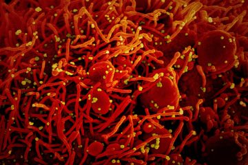 Corona-Epidemie / „Santé“ meldet 123 Neuinfektionen am Sonntag – keine weiteren Menschen gestorben