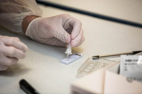 Der Abstrich wird mit einer Flüssigkeit vermischt, anschließend kommt ein Tropfen auf den Schnelltest