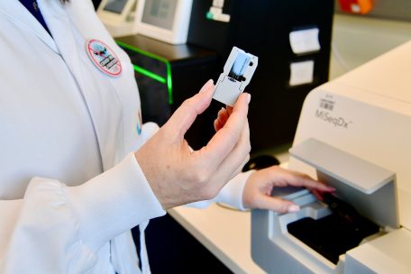 Auf diesem winzigen Chip liegen am Ende die Daten, auf denen die DNA der 150 bp langen Sequenzen zu erkennen ist 