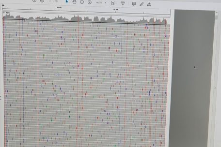 Die unteren grauen Linien sind die Sequenzen. Oben ist die „Konsensussequenz“ der Probe. Die durchgehenden Farbstriche sind Mutationen. 