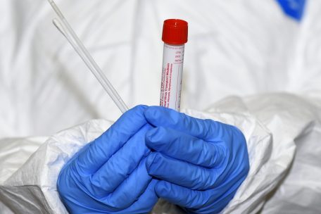 Corona / Taskforce: „Epidemische Situation weiterhin instabil“