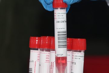 Coronavirus / In Luxemburg sind wieder 123 Neuinfektionen festgestellt worden – bei 8.725 Tests