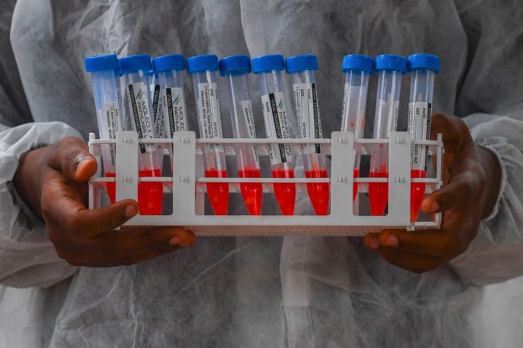 LST Howald / Spucken statt Stäbchen: „Santé“ führt neue Technik für PCR-Tests ein
