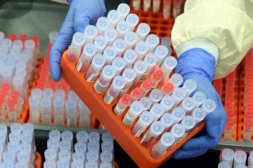 Regierungsrat / Wer sich aus medizinischen Gründen nicht impfen lassen kann, erhält weiter kostenlose PCR-Tests