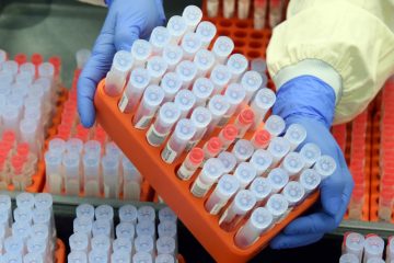 Pandemie / „Santé“ meldet 131 Neuinfektionen aus 2.600 Tests