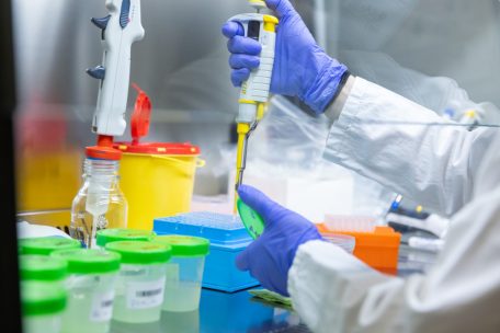 Coronavirus / „Santé“ meldet am Donnerstag 570 Neuinfektionen – drei weitere Todesfälle