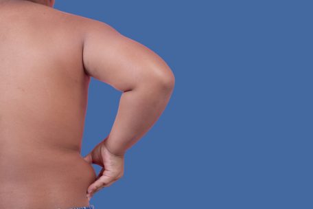 Gesundheit / Übergewicht und Bewegungsmangel: Wieso Luxemburg schlecht abschneidet