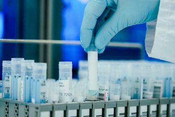 Pandemie / Erneuter Höchststand: „Santé“ meldet am Donnerstag 3.064 Infektionen – keine weiteren Todesfälle
