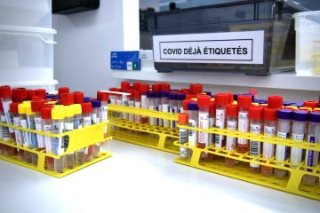Corona-Pandemie / „Santé“ meldet am Dienstag: 1.060 von 3.781 Tests positiv – eine weitere Person stirbt