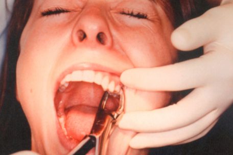 Vor Gericht / Horror-Zahnarzt zog massenhaft gesunde Zähne im Armenviertel von Marseille