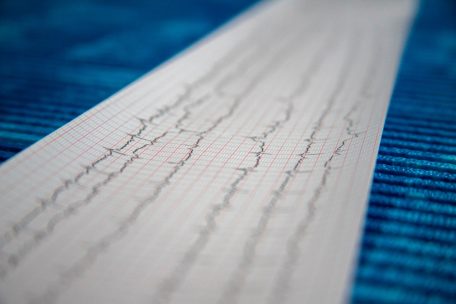 Forschung / Hinweise auf Ursache für Herzmuskelentzündungen nach Corona-Impfung