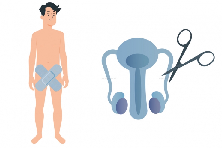 „Interesse in Luxemburg steigt“ / Wie verlaufen Vasektomien? – Ein Urologe und ein Patient geben Erklärungen