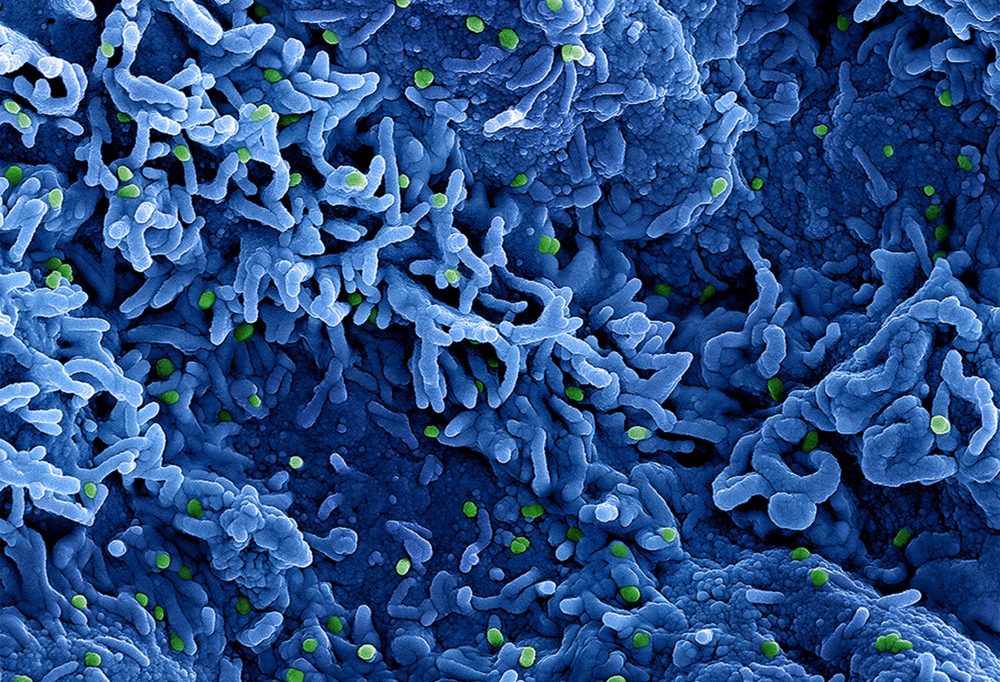 Mpox-Virus / Trotz weltweiter Notlage: Risiko für Luxemburg derzeit als gering eingestuft