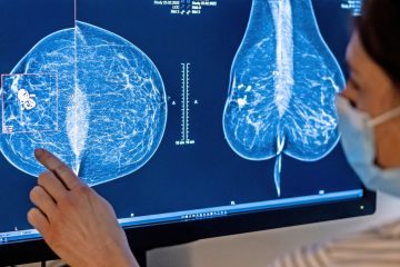 Luxemburg / Krebs-Früherkennung: Mammografie und Darmkrebsvorsorge können Leben retten