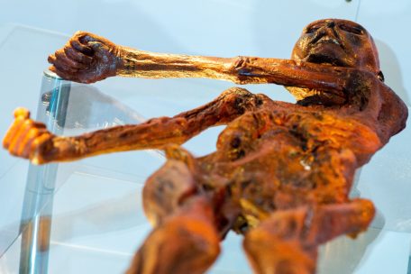 Opfer eines Verbrechens: Ötzi, der Mann aus dem Eis