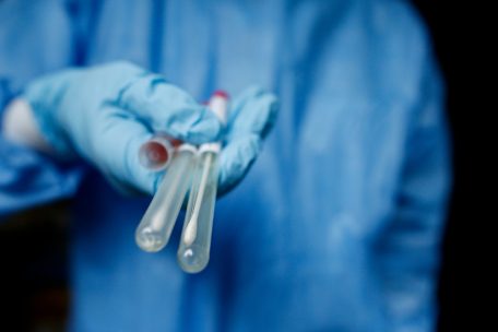 Coronavirus  / Luxemburger Forscher untersuchen Rolle des Magen-Darm-Trakts bei Long Covid