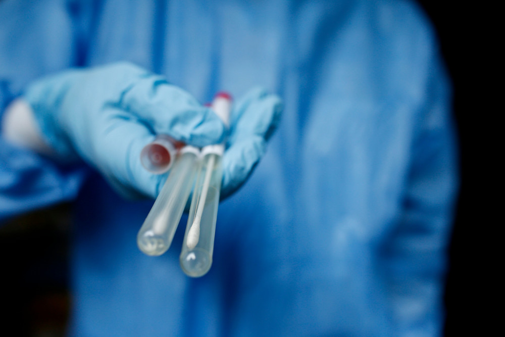 Coronavirus  / Luxemburger Forscher untersuchen Rolle des Magen-Darm-Trakts bei Long Covid