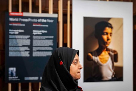 Fotografie / Porträt eines versehrten palästinensischen Jungen gewinnt World Press Photo Award