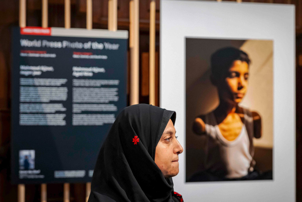 Fotografie / Porträt eines versehrten palästinensischen Jungen gewinnt World Press Photo Award