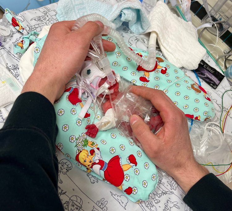 Deutschland / Winziges Baby kommt mit 265 Gramm zur Welt