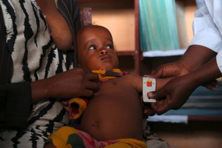 Entwicklungshilfe / Die finanzielle Lage vieler Hilfs- und UN-Organisationen ist dramatisch