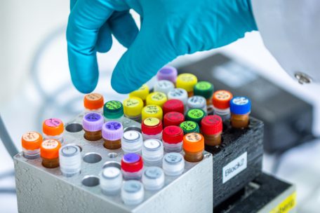 2025 / Gesundheitsministerium meldet 39 EHEC-Infektionen in Luxemburg