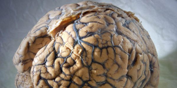 Nervenzellen werden Teil des Gehirns