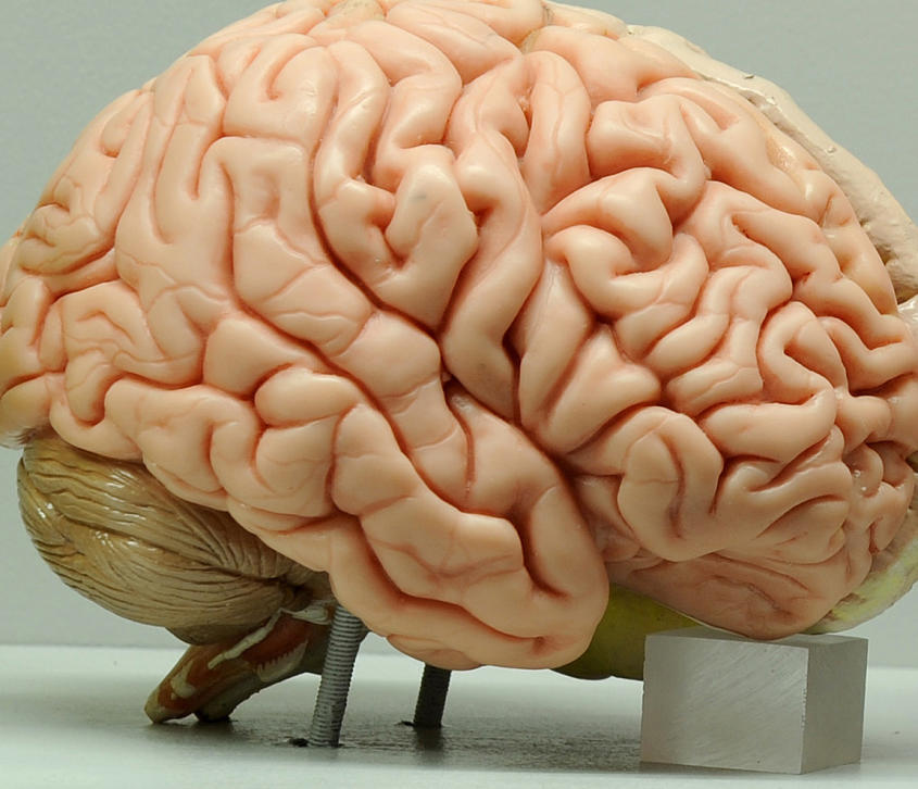 Musk will Gehirn mit Computern vernetzen
