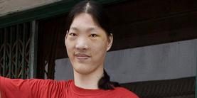Größte Frau der Welt in China gestorben