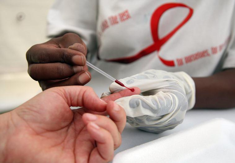 Lösungen zum Beenden der HIV-Epidemie