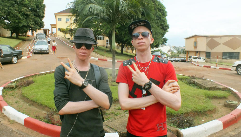 Albino-Musiker rappen gegen Vorurteile